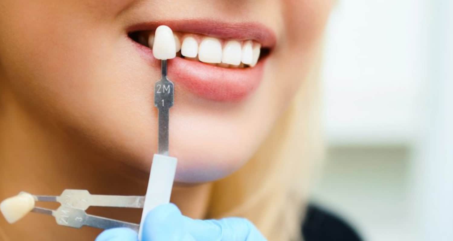 How To Finance Dental Implants? 4 Ways
